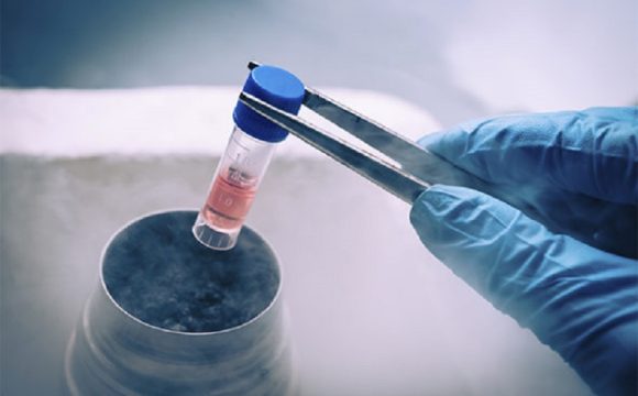 انجماد و ذوب اسپرم در تکنیکهای باروری آزمایشگاهی